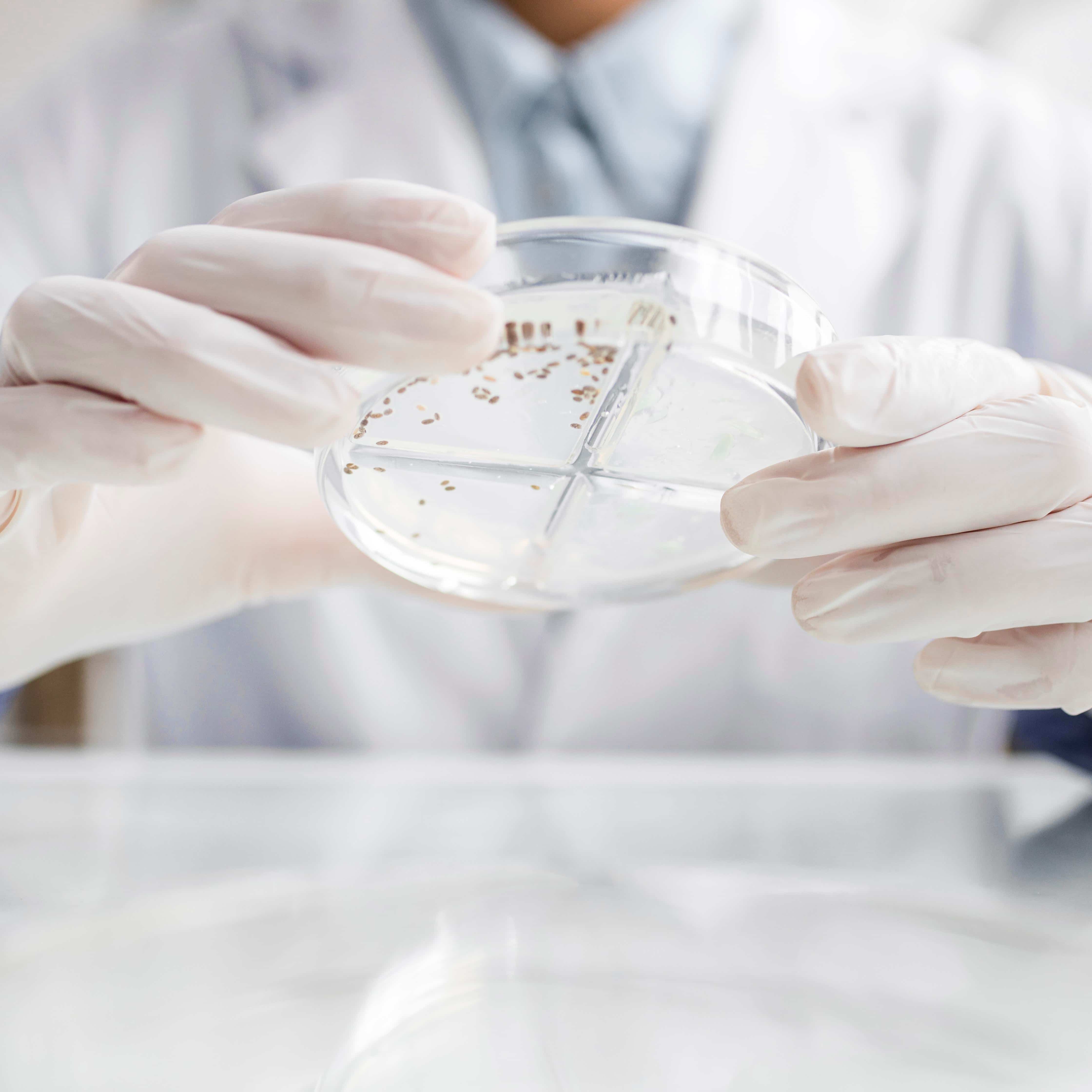 Microbiological Analysis and Antibacterial Activity